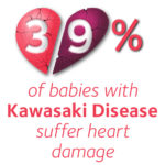 39% of babies diagnosed with Kawasaki Disease develop serious heart damage – new study shows