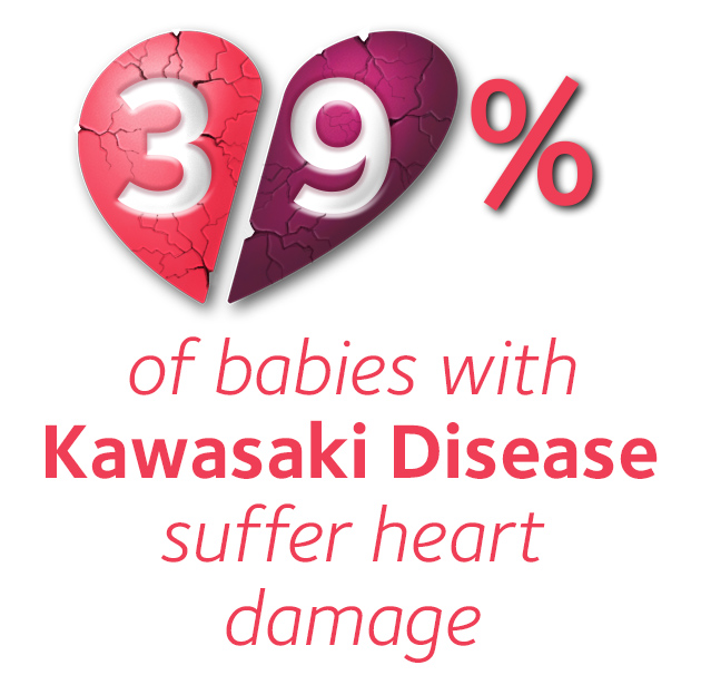 39% of babies diagnosed with Kawasaki Disease develop serious heart damage