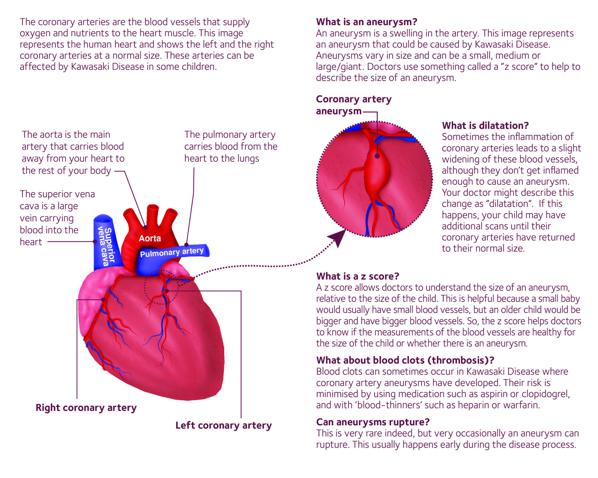 What is a coronary artery aneurysm02 Societi