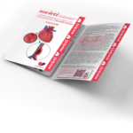 Lifetime management of patients with heart damage due to Kawasaki Disease  – A quick guide